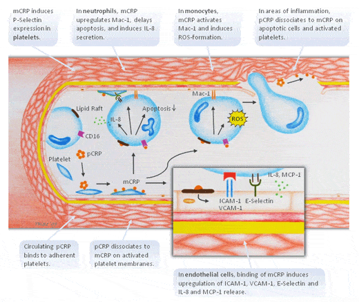 Inflammation and reperfusion injury