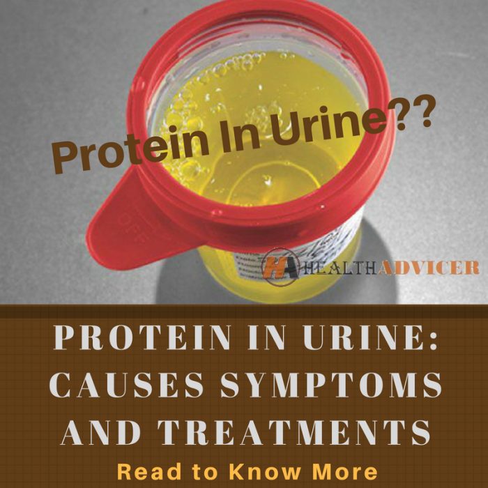 Protein In Urine : Causes, Picture, Symptoms And Treatment